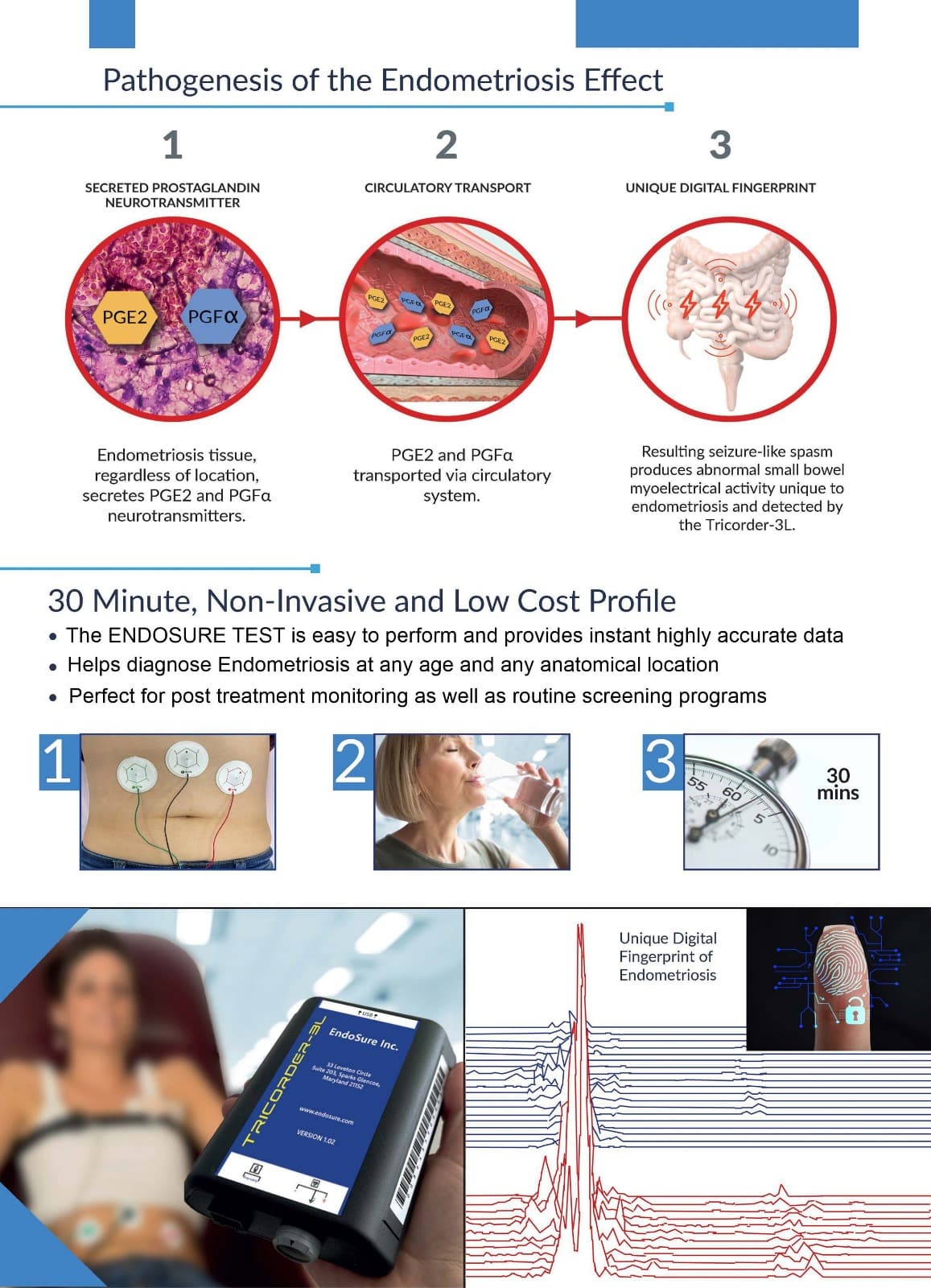 EndoDiagnosis, Inc Exhibits TIER-1 ENDOSURE Diagnostic Test for Endometriosis at AAGL 2025 in Vancouver, BC, Canada