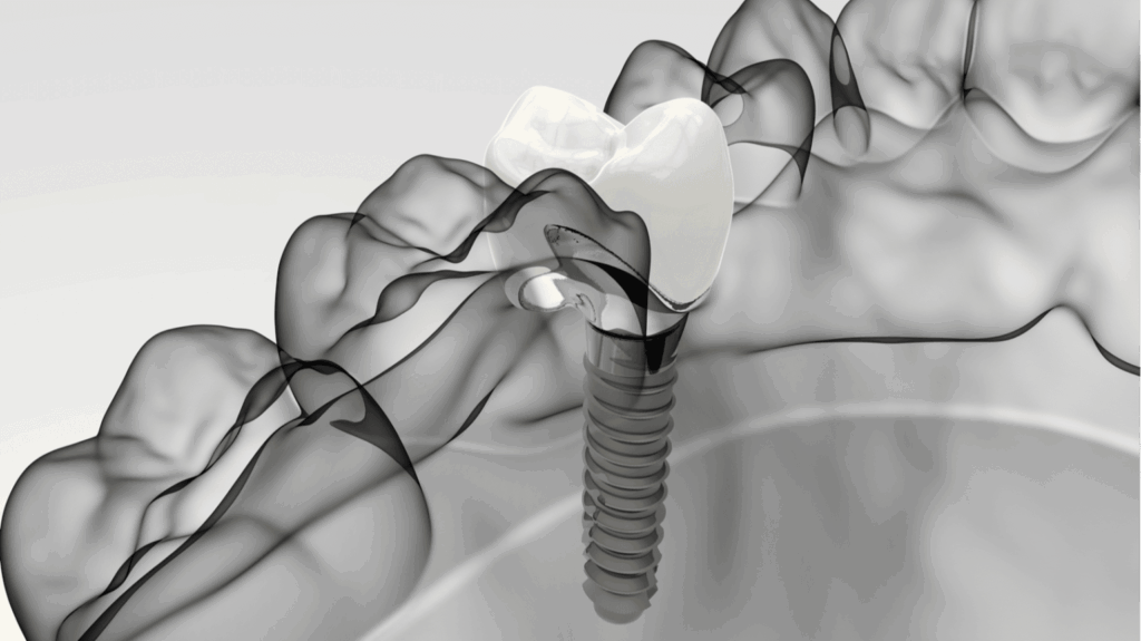 Featured image for Auto-prepared featured image